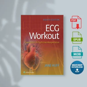 ECG Workout-Exercises in Arrhythmia Interpretat_.