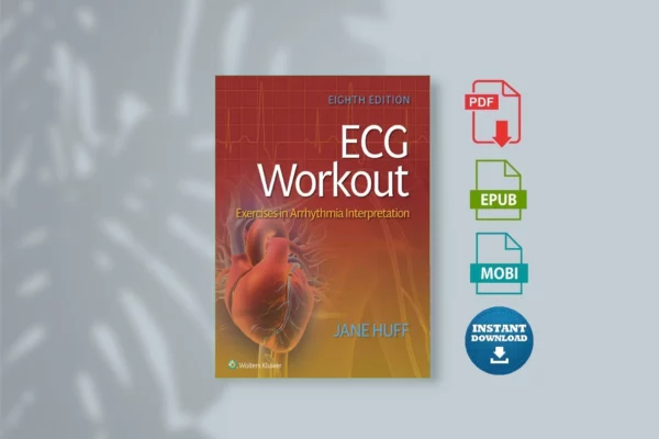 ECG Workout-Exercises in Arrhythmia Interpretat_.
