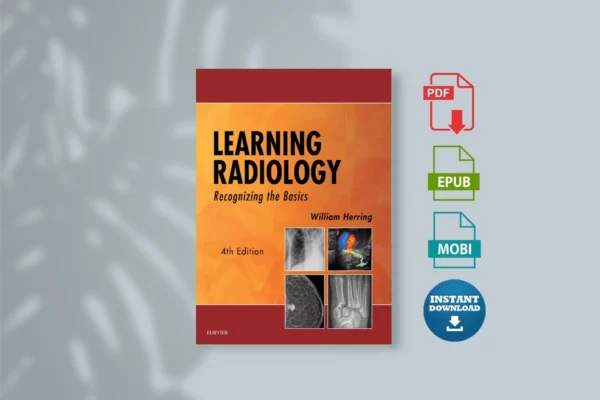 Learning Radiology Recognizing the Basics (William Herring MD FACR)